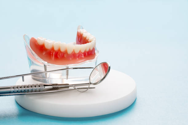 Full Mouth Reconstruction in Hollister, CA